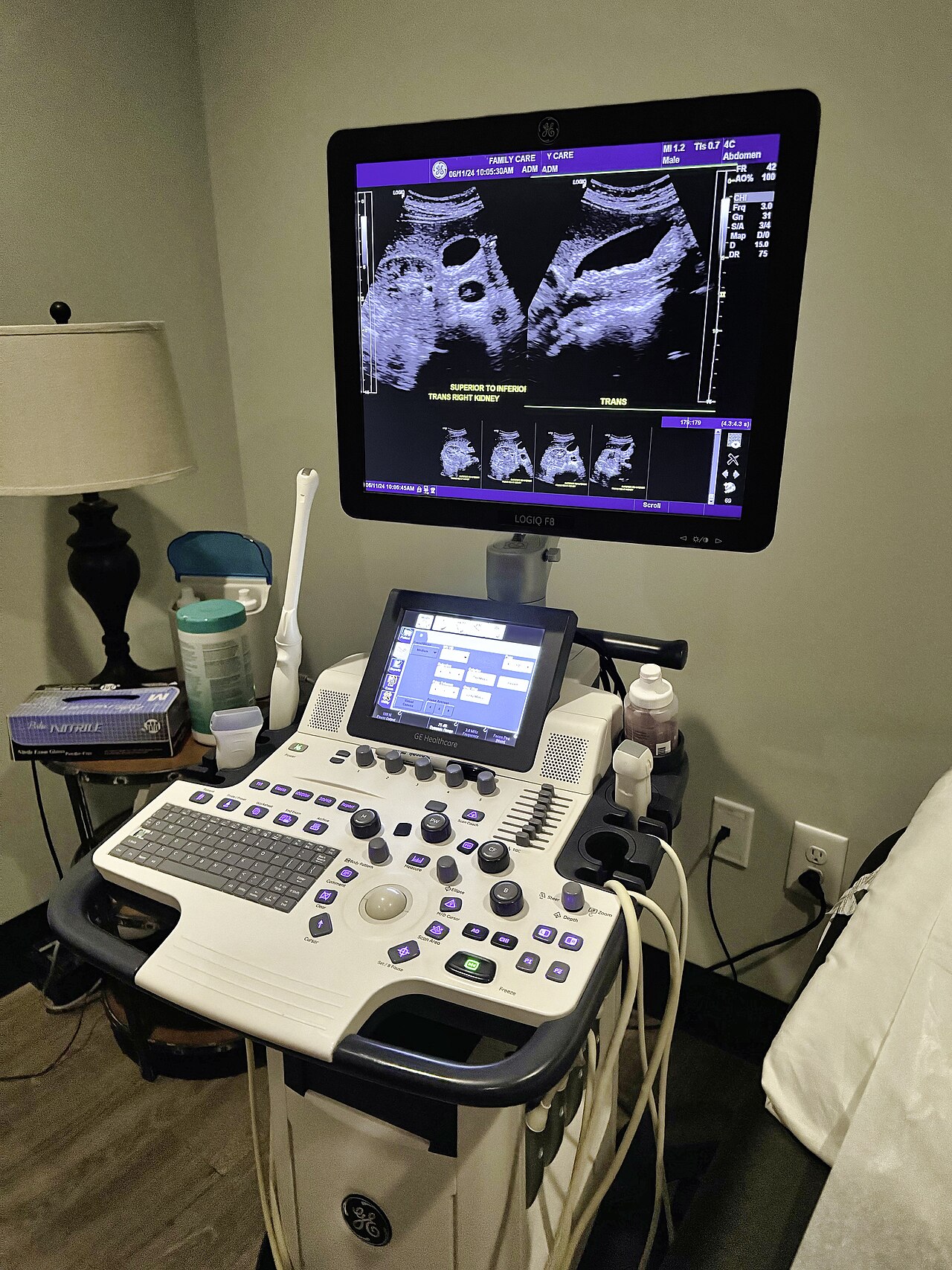 Echographe portable ECH-P10